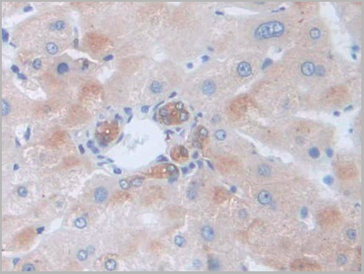 product-image-AAA20135_IHC5.jpg