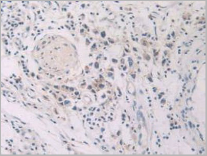 product-image-AAA20135_IHC6.jpg