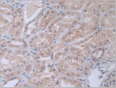 product-image-AAA20135_IHC7.jpg
