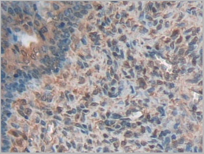 product-image-AAA20136_IHC2.jpg