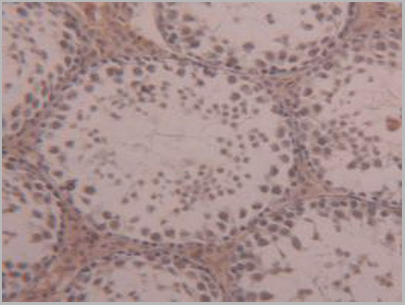 product-image-AAA20141_IHC3.jpg