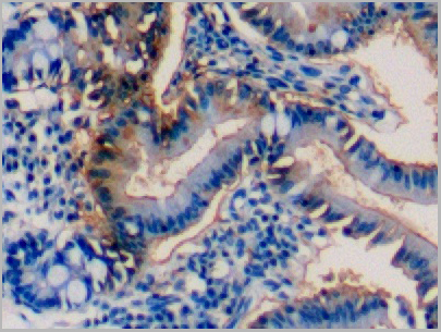 product-image-AAA20145_IHC.jpg