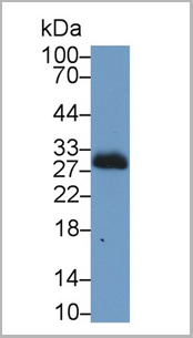 product-image-AAA20145_WB3.png