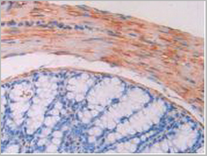 product-image-AAA20149_IHC5.jpg