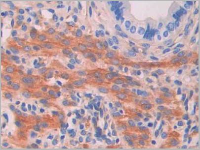 product-image-AAA20149_IHC6.jpg