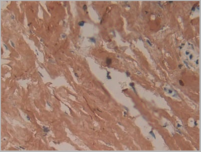 product-image-AAA20154_IHC4.jpg