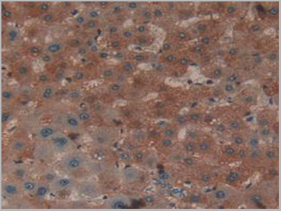 product-image-AAA20154_IHC5.jpg