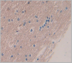 product-image-AAA20157_IHC6.jpg