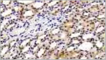 product-image-AAA20159_IHC2.jpg