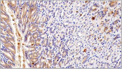 product-image-AAA20160_IHC3.jpg