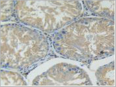 product-image-AAA20164_IHC3.jpg