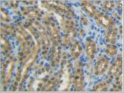 product-image-AAA20164_IHC4.jpg