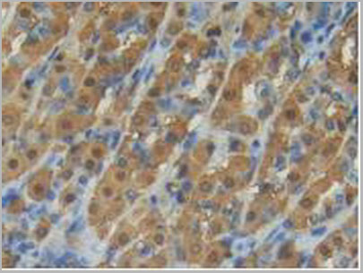 product-image-AAA20164_IHC5.jpg