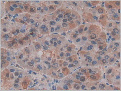 product-image-AAA20165_IHC5.jpg