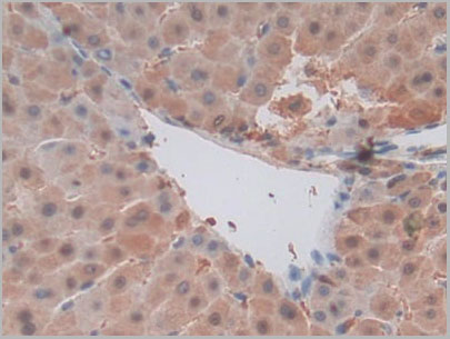 product-image-AAA20165_IHC6.jpg