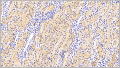 product-image-AAA20167_IHC2.jpg