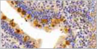 product-image-AAA20167_IHC3.jpg