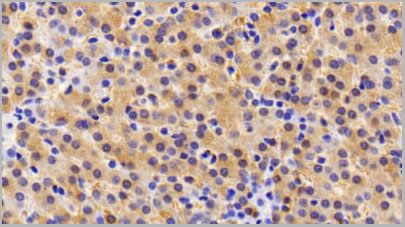 product-image-AAA20167_IHC4.jpg