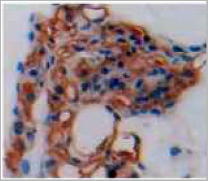 product-image-AAA20171_IHC3.jpg