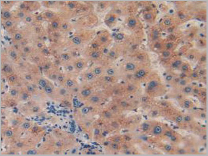 product-image-AAA20172_IHC2.jpg