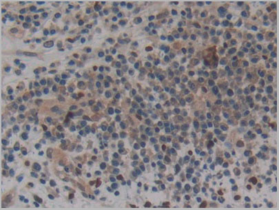 product-image-AAA20172_IHC3.jpg