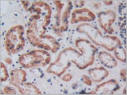 product-image-AAA20172_IHC4.jpg