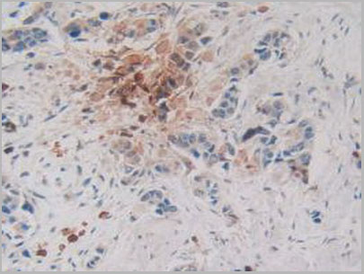 product-image-AAA20172_IHC5.jpg