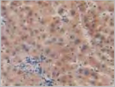 product-image-AAA20172_IHC6.jpg