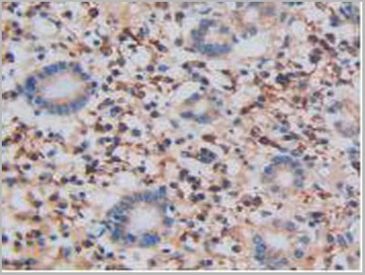 product-image-AAA20173_IHC4.jpg