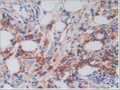 product-image-AAA20173_IHC5.jpg