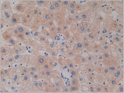 product-image-AAA20173_IHC6.jpg