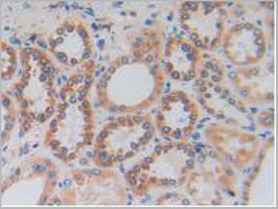 product-image-AAA20173_IHC8.jpg