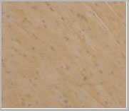 product-image-AAA20174_IHC3.jpg