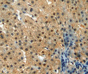 product-image-AAA20177_IHC6.jpg