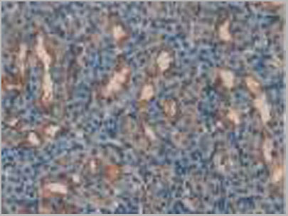 product-image-AAA20182_IHC.jpg