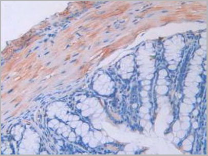 product-image-AAA20191_IHC4.jpg