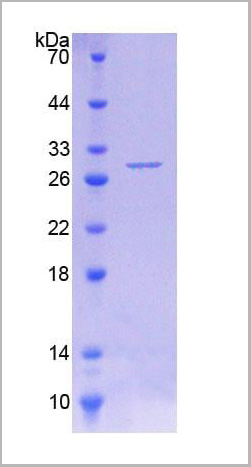 product-image-AAA20225_SDS_PAGE3.jpg