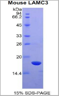 product-image-AAA20229_SDS_PAGE.jpg