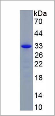 product-image-AAA20271_SDS_PAGE2.jpg
