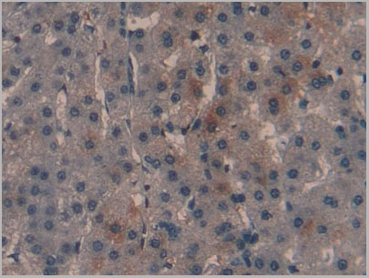 product-image-AAA20299_IHC7.jpg