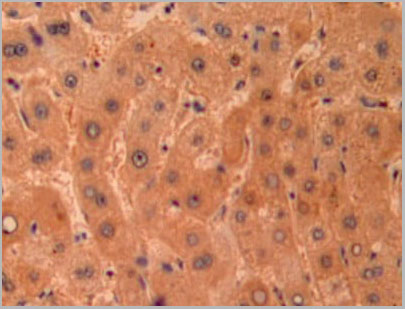 product-image-AAA20300_IHC4.jpg