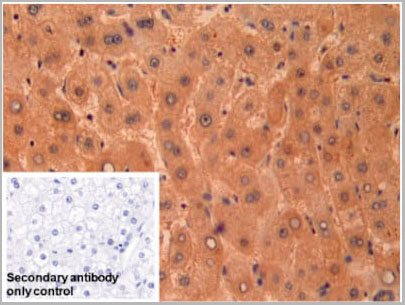 product-image-AAA20300_IHC5.jpg