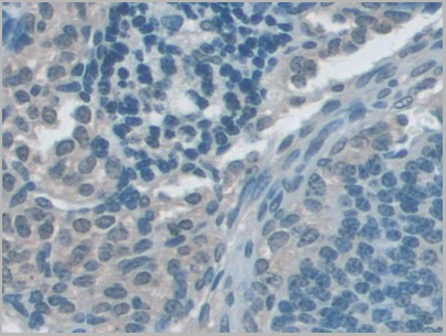 product-image-AAA20310_IHC6.jpg