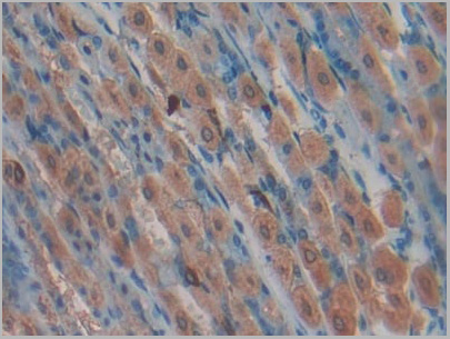 product-image-AAA20311_IHC4.jpg