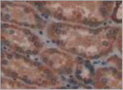 product-image-AAA20313_IHC3.jpg