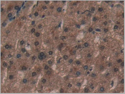 product-image-AAA20313_IHC5.jpg