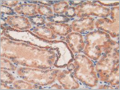 product-image-AAA20313_IHC6.jpg