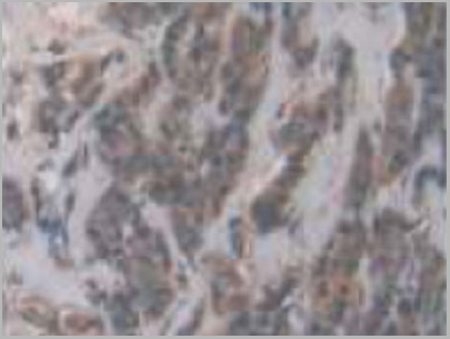 product-image-AAA20313_IHC7.jpg