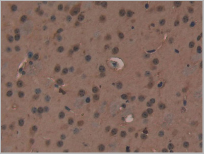 product-image-AAA20315_IHC6.jpg