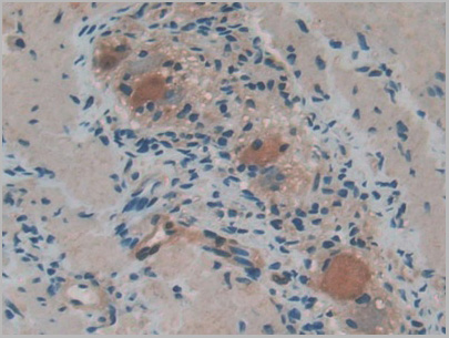 product-image-AAA20319_IHC5.jpg